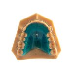 Dentaurum 3D Διαχωριστικό Ακρυλικού - Image 2