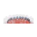 Dentaurum Discovery® Delight Μοντέλο παρουσίασης - Image 2