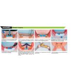 Χυτευόμενες υποδοχές για κλιπ - Image 3